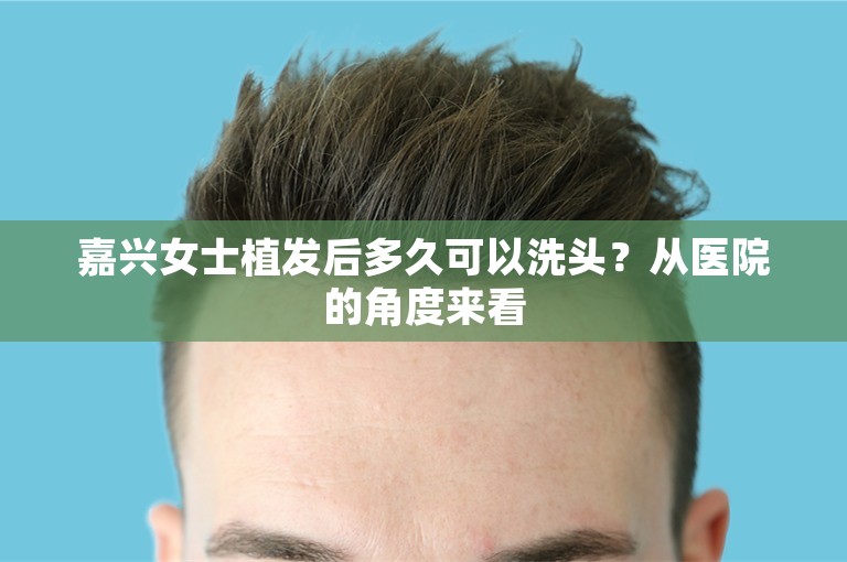 嘉兴女士植发后多久可以洗头？从医院的角度来看