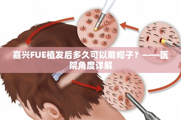 嘉兴FUE植发后多久可以戴帽子？——医院角度详解