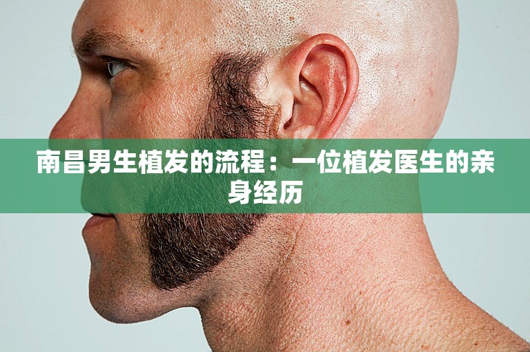 南昌男生植发的流程：一位植发医生的亲身经历