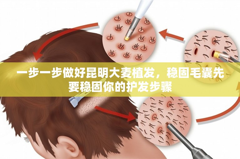 一步一步做好昆明大麦植发，稳固毛囊先要稳固你的护发步骤