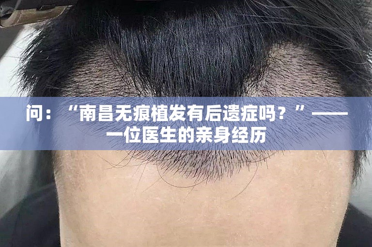 问：“南昌无痕植发有后遗症吗？”——一位医生的亲身经历