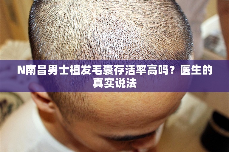 N南昌男士植发毛囊存活率高吗？医生的真实说法