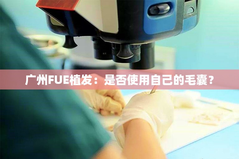 广州FUE植发：是否使用自己的毛囊？