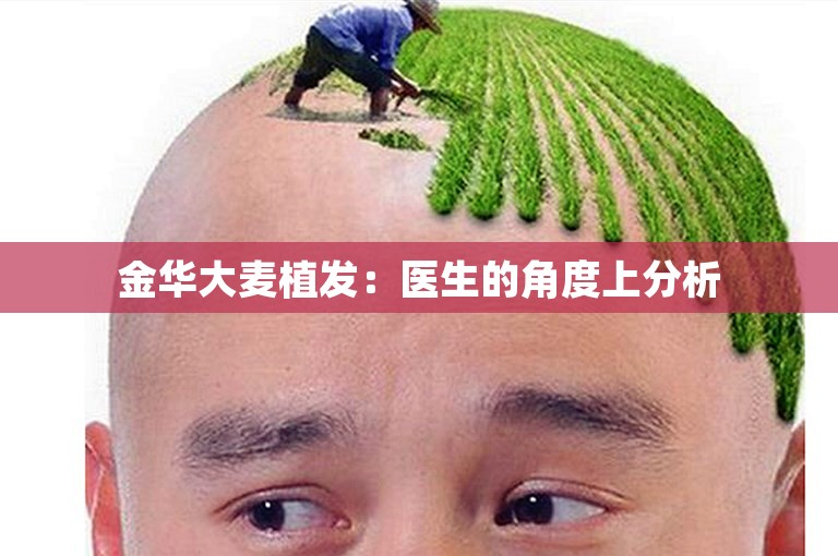 金华大麦植发：医生的角度上分析