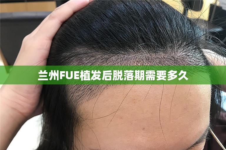 兰州FUE植发后脱落期需要多久