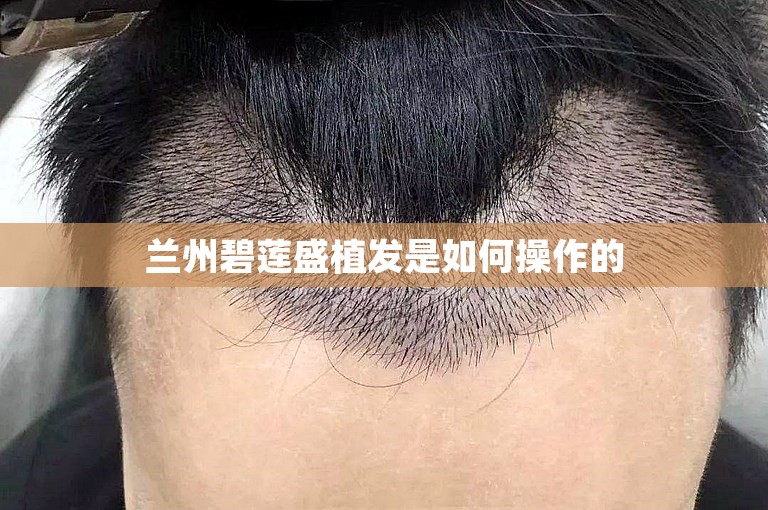 兰州碧莲盛植发是如何操作的