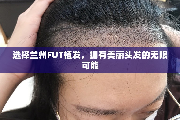 选择兰州FUT植发，拥有美丽头发的无限可能