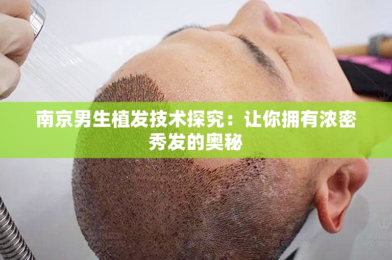 南京男生植发技术探究：让你拥有浓密秀发的奥秘