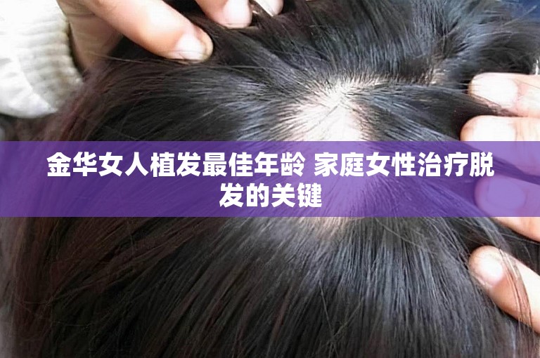 金华女人植发最佳年龄 家庭女性治疗脱发的关键