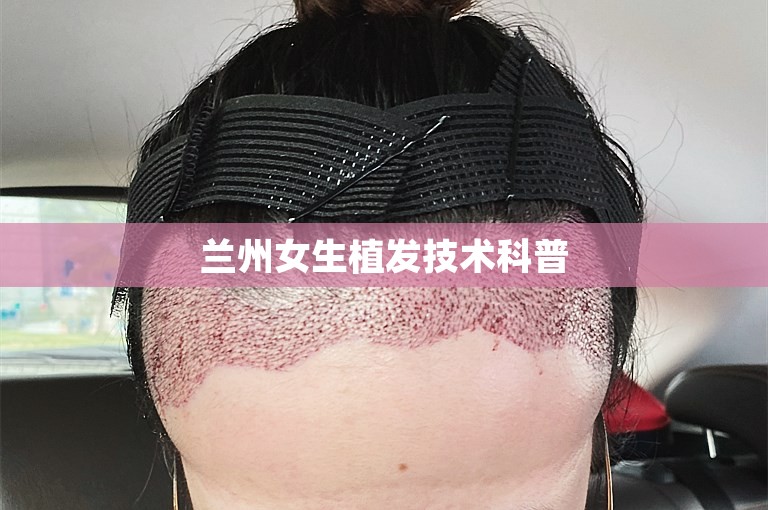 兰州女生植发技术科普