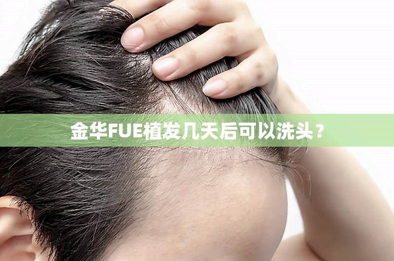 金华FUE植发几天后可以洗头？