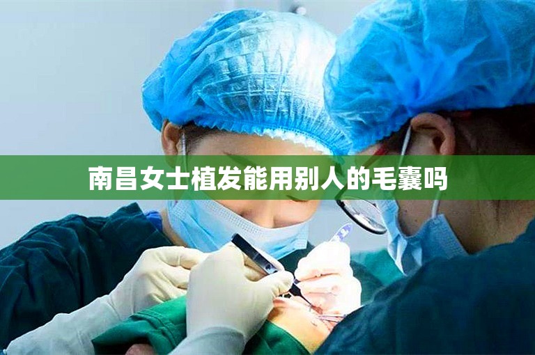 南昌女士植发能用别人的毛囊吗