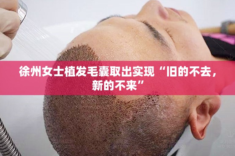 徐州女士植发毛囊取出实现“旧的不去，新的不来”