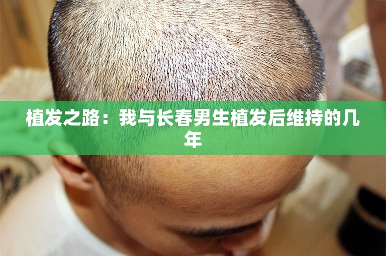 植发之路：我与长春男生植发后维持的几年