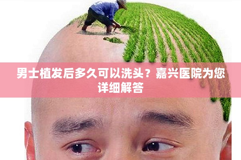 男士植发后多久可以洗头？嘉兴医院为您详细解答