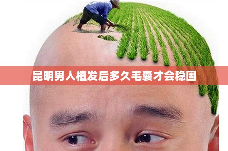 昆明男人植发后多久毛囊才会稳固