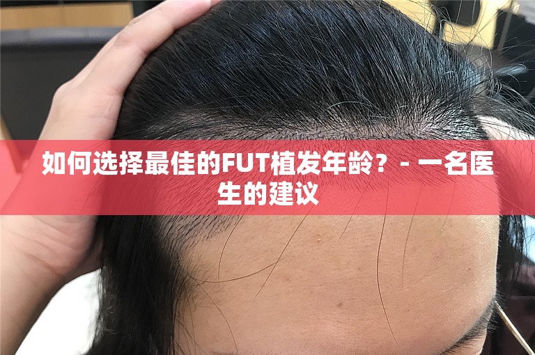 如何选择最佳的FUT植发年龄？- 一名医生的建议