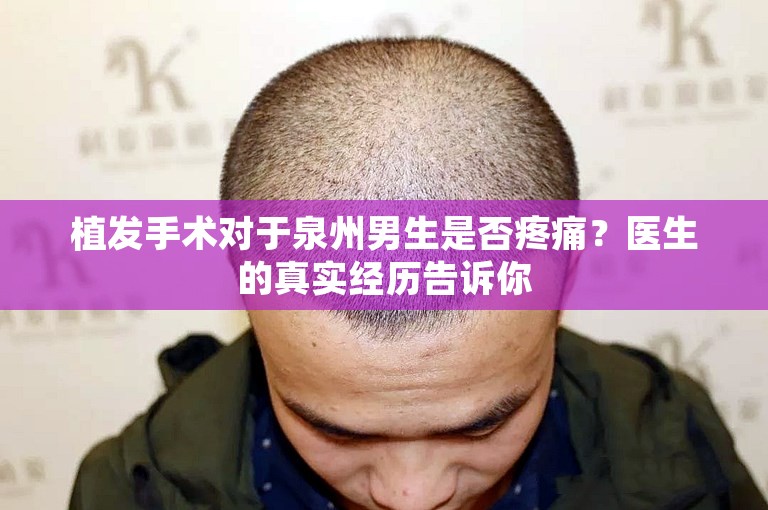 植发手术对于泉州男生是否疼痛？医生的真实经历告诉你