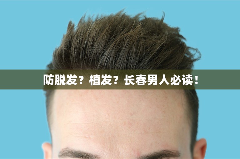 防脱发？植发？长春男人必读！