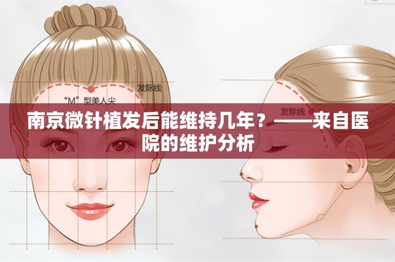 南京微针植发后能维持几年？——来自医院的维护分析