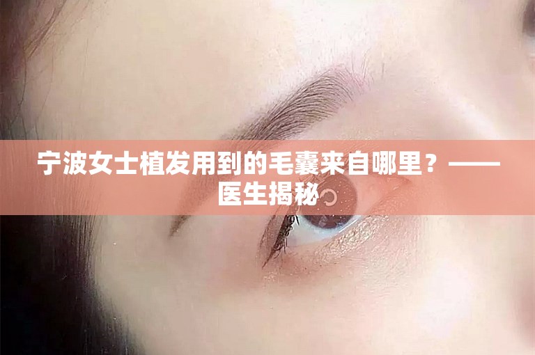 宁波女士植发用到的毛囊来自哪里？——医生揭秘