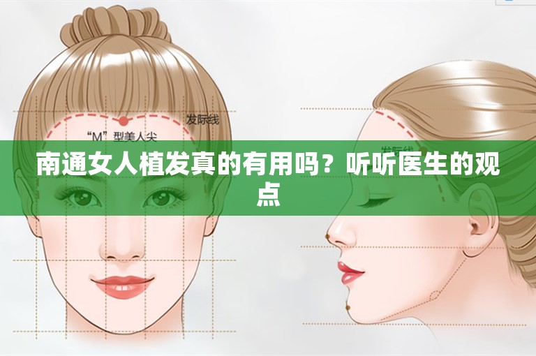 南通女人植发真的有用吗？听听医生的观点