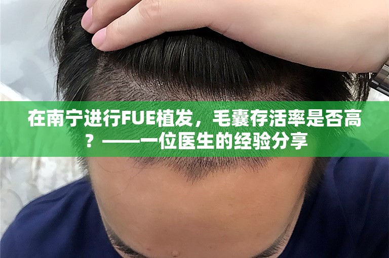 在南宁进行FUE植发，毛囊存活率是否高？——一位医生的经验分享