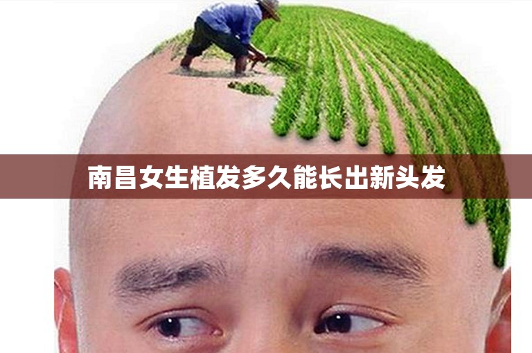 南昌女生植发多久能长出新头发