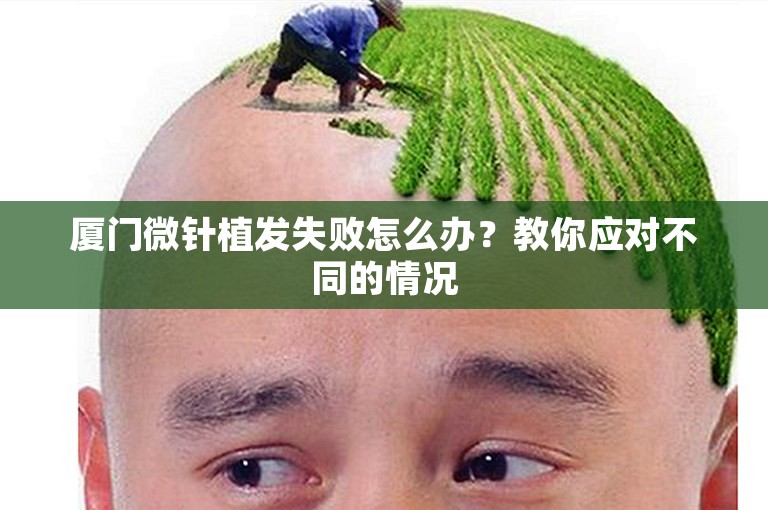 厦门微针植发失败怎么办？教你应对不同的情况