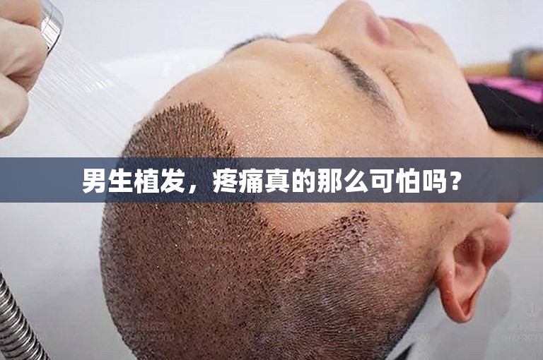 男生植发，疼痛真的那么可怕吗？