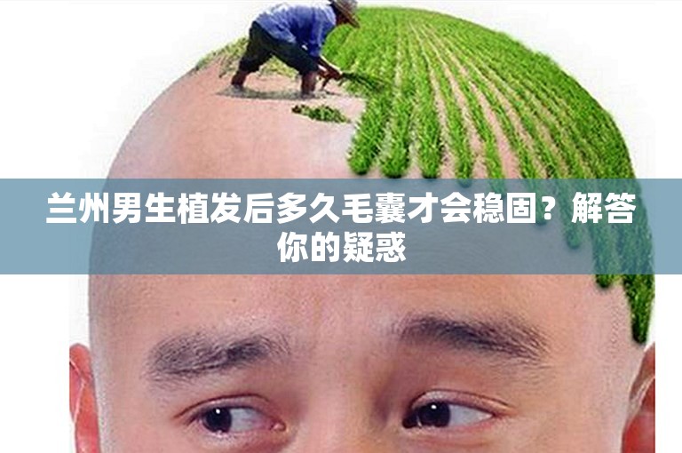 兰州男生植发后多久毛囊才会稳固？解答你的疑惑