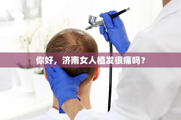 你好，济南女人植发很痛吗？