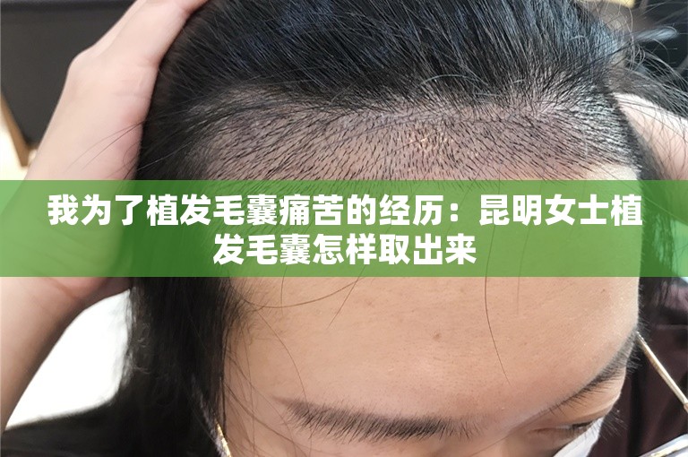 我为了植发毛囊痛苦的经历：昆明女士植发毛囊怎样取出来