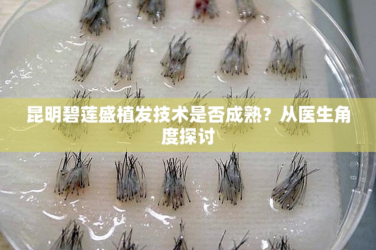 昆明碧莲盛植发技术是否成熟？从医生角度探讨