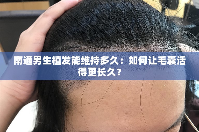 南通男生植发能维持多久：如何让毛囊活得更长久？