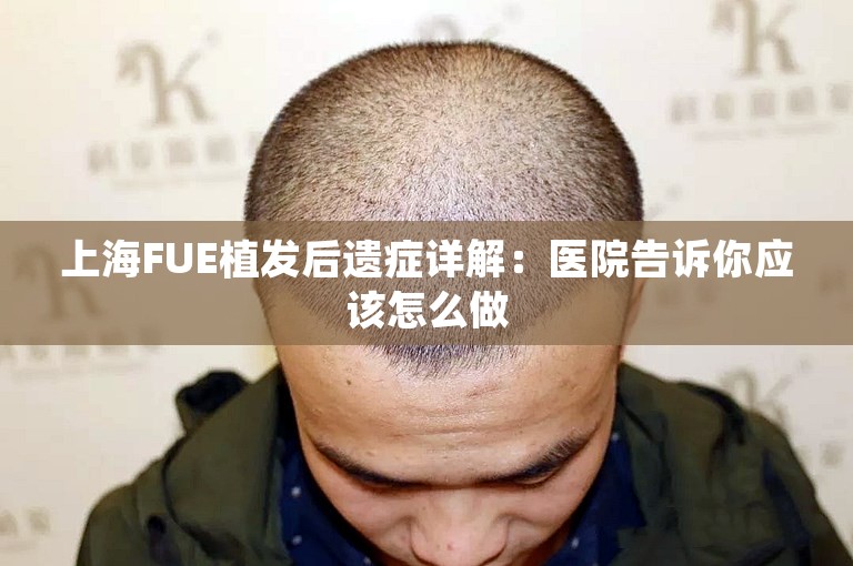 上海FUE植发后遗症详解：医院告诉你应该怎么做