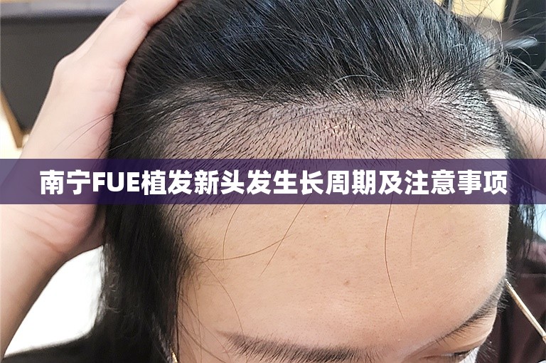 南宁FUE植发新头发生长周期及注意事项