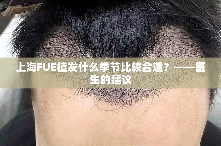 上海FUE植发什么季节比较合适？——医生的建议