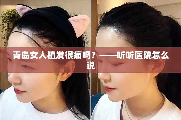 青岛女人植发很痛吗？——听听医院怎么说