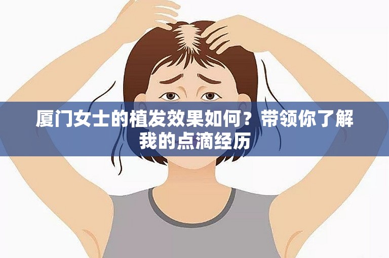 厦门女士的植发效果如何？带领你了解我的点滴经历