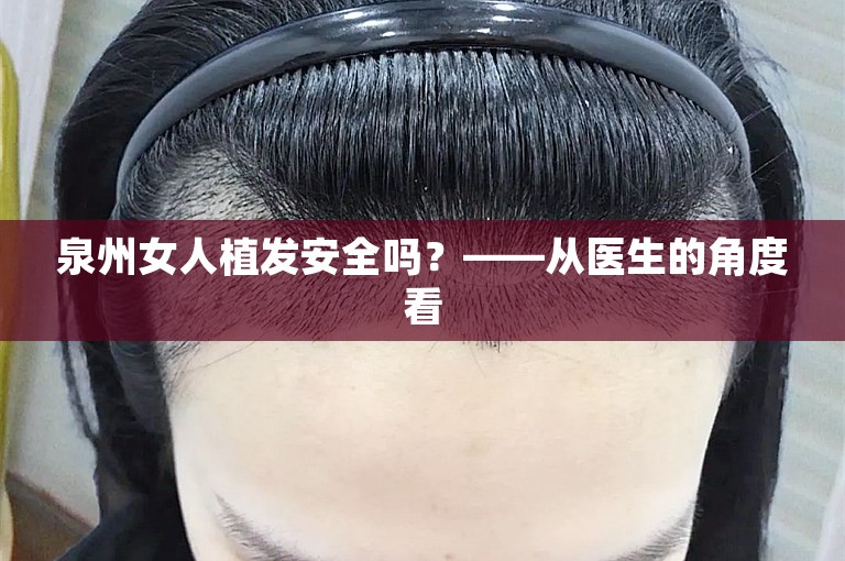 泉州女人植发安全吗？——从医生的角度看