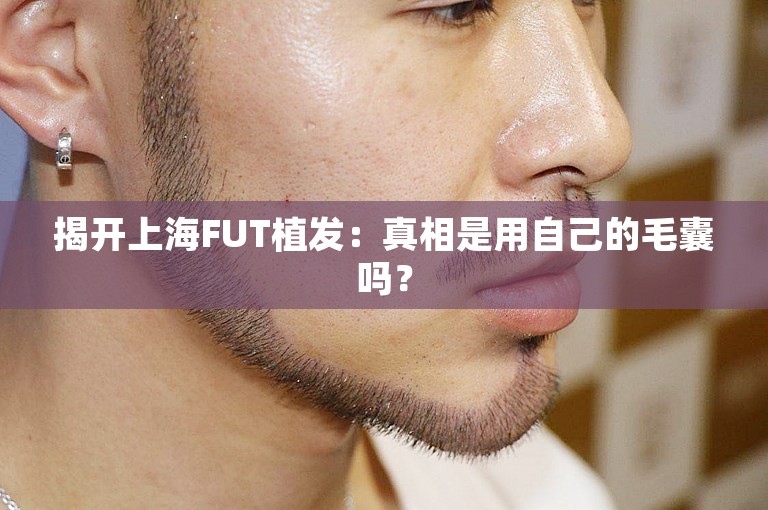 揭开上海FUT植发：真相是用自己的毛囊吗？