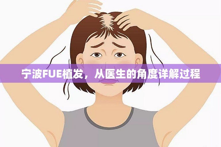 宁波FUE植发，从医生的角度详解过程