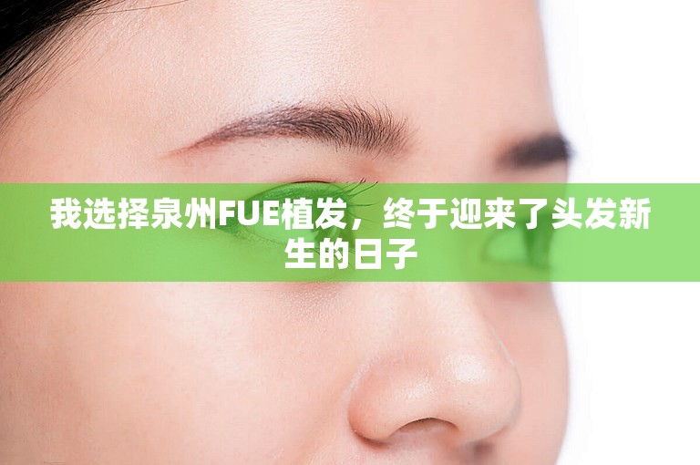 我选择泉州FUE植发，终于迎来了头发新生的日子