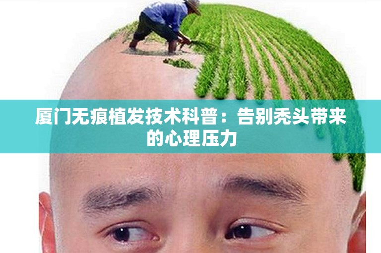 厦门无痕植发技术科普：告别秃头带来的心理压力