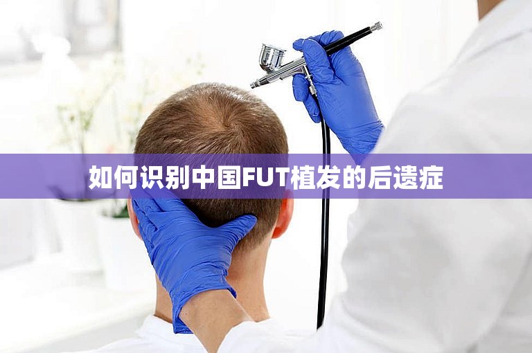 如何识别中国FUT植发的后遗症