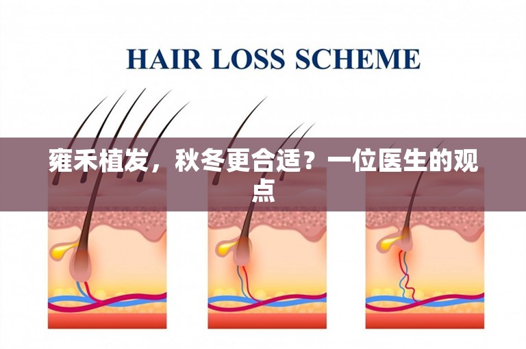 雍禾植发，秋冬更合适？一位医生的观点