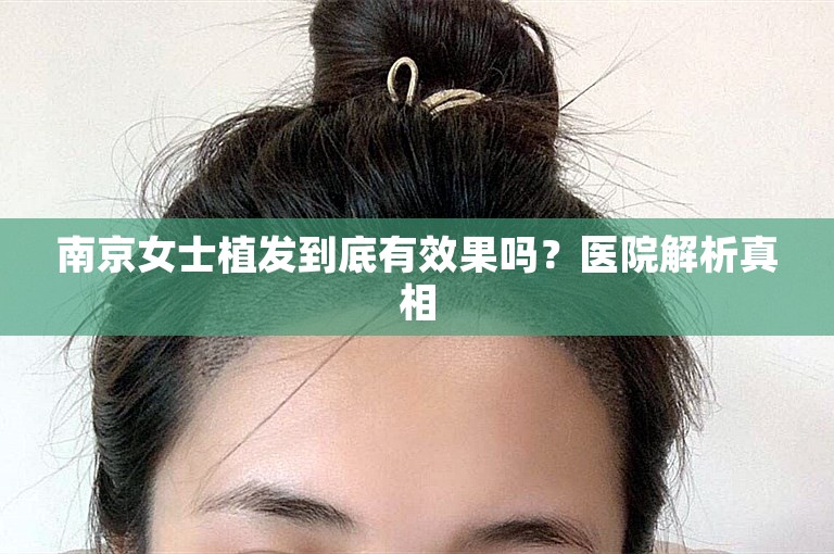 南京女士植发到底有效果吗？医院解析真相