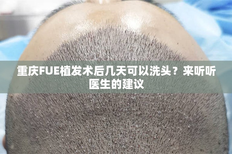 重庆FUE植发术后几天可以洗头？来听听医生的建议