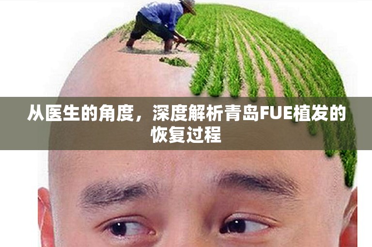 从医生的角度，深度解析青岛FUE植发的恢复过程